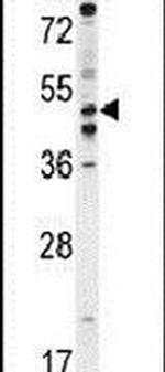 PDE7B Antibody in Western Blot (WB)