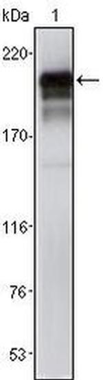 PDGFRB Monoclonal Antibody (1A2)