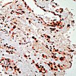 PDGFRA Antibody in Immunohistochemistry (IHC)