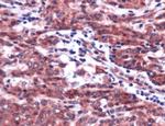 PDGFRB Antibody in Immunohistochemistry (IHC)