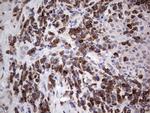 PDGFRA Antibody in Immunohistochemistry (Paraffin) (IHC (P))
