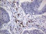 PDGFRA Antibody in Immunohistochemistry (Paraffin) (IHC (P))