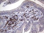 PDGFRA Antibody in Immunohistochemistry (Paraffin) (IHC (P))