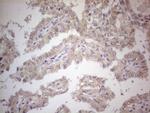PDGFRA Antibody in Immunohistochemistry (Paraffin) (IHC (P))