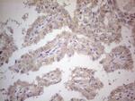 PDGFRA Antibody in Immunohistochemistry (Paraffin) (IHC (P))