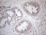 PDGFRA Antibody in Immunohistochemistry (Paraffin) (IHC (P))