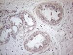 PDGFRA Antibody in Immunohistochemistry (Paraffin) (IHC (P))