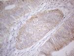 PDGFRA Antibody in Immunohistochemistry (Paraffin) (IHC (P))