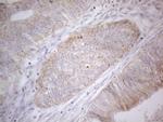 PDGFRA Antibody in Immunohistochemistry (Paraffin) (IHC (P))