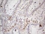 PDGFRA Antibody in Immunohistochemistry (Paraffin) (IHC (P))