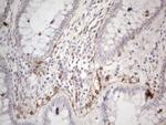 PDGFRA Antibody in Immunohistochemistry (Paraffin) (IHC (P))