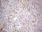 PDGFRA Antibody in Immunohistochemistry (Paraffin) (IHC (P))