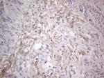 PDGFRA Antibody in Immunohistochemistry (Paraffin) (IHC (P))