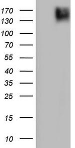 PDGFRA Antibody in Western Blot (WB)