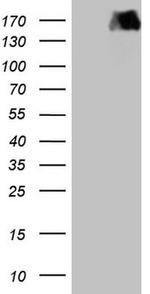 PDGFRA Antibody in Western Blot (WB)