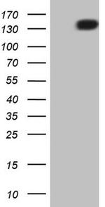 PDGFRA Antibody in Western Blot (WB)