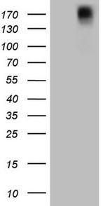 PDGFRA Antibody in Western Blot (WB)