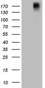 PDGFRA Antibody in Western Blot (WB)