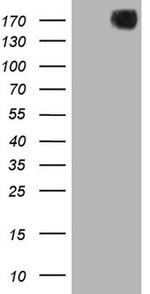 PDGFRA Antibody in Western Blot (WB)