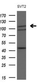 PDGFRA Antibody in Western Blot (WB)