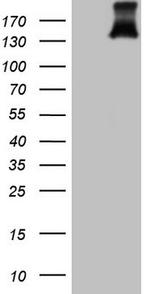 PDGFRA Antibody in Western Blot (WB)