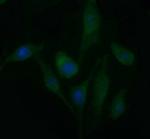 PDGFRB Antibody in Immunocytochemistry (ICC/IF)