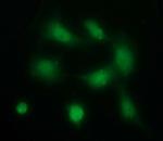 PDGFRB Antibody in Immunocytochemistry (ICC/IF)