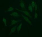 PDGFRB Antibody in Immunocytochemistry (ICC/IF)