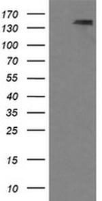 PDGFRB Antibody in Western Blot (WB)