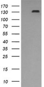 PDGFRB Antibody in Western Blot (WB)