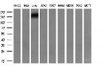 PDGFRB Antibody in Western Blot (WB)