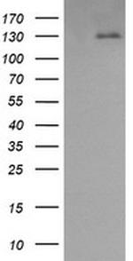 PDGFRB Antibody in Western Blot (WB)