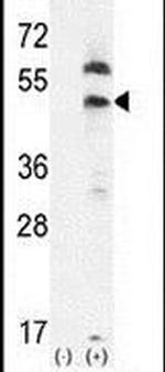 PDGFRL Antibody in Western Blot (WB)