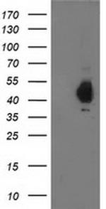 PDHA1 Antibody in Western Blot (WB)
