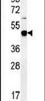 PDHA1 Antibody in Western Blot (WB)