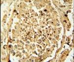 PDHA2 Antibody in Immunohistochemistry (IHC)