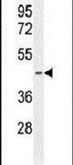 PDHA2 Antibody in Western Blot (WB)