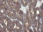 PDIA3 Antibody in Immunohistochemistry (Paraffin) (IHC (P))