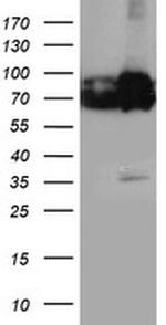 PDIA4 Antibody in Western Blot (WB)