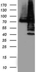 PDIA4 Antibody in Western Blot (WB)
