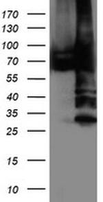 PDIA4 Antibody in Western Blot (WB)