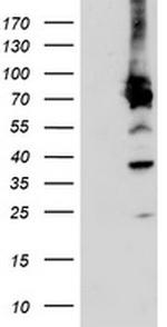 PDIA4 Antibody in Western Blot (WB)