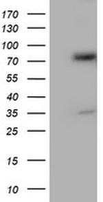 PDIA4 Antibody in Western Blot (WB)
