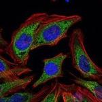 PDK1 Monoclonal Antibody (4A11)