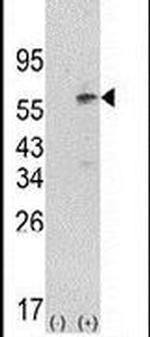 PDPK1 Antibody in Western Blot (WB)