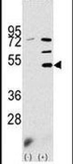 PDK3 Antibody in Western Blot (WB)