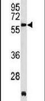 PDK3 Antibody in Western Blot (WB)