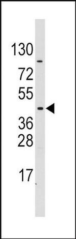 PDK4 Antibody in Western Blot (WB)