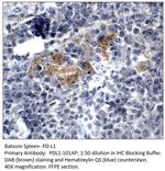 PD-L1 Antibody in Immunohistochemistry (IHC)