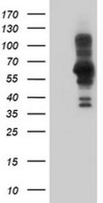 PDLIM5 Antibody in Western Blot (WB)